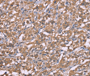 Anti-Histamine H3 Receptor antibody used in IHC (Paraffin sections) (IHC-P). GTX04933