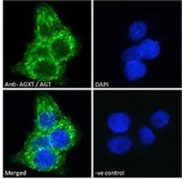 Anti-AGXT antibody used in Immunocytochemistry/ Immunofluorescence (ICC/IF). GTX04937