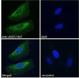 Anti-AGXT antibody used in Immunocytochemistry/ Immunofluorescence (ICC/IF). GTX04937