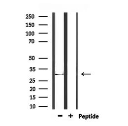Anti-IL1 alpha antibody used in Western Blot (WB). GTX04939