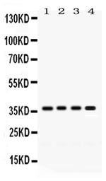 Anti-FOXA3 antibody used in Western Blot (WB). GTX04941