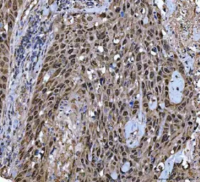 Anti-Twist1/2 antibody used in IHC (Paraffin sections) (IHC-P). GTX04942
