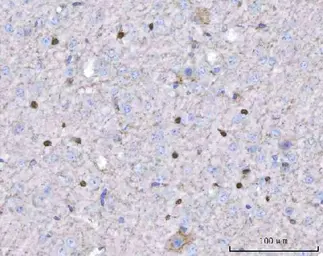 Anti-Twist1/2 antibody used in IHC (Paraffin sections) (IHC-P). GTX04942