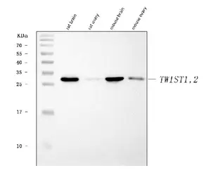 Anti-Twist1/2 antibody used in Western Blot (WB). GTX04942