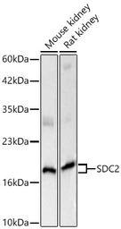 Anti-SDC2 antibody used in Western Blot (WB). GTX04944