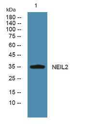 Anti-NEIL2 antibody used in Western Blot (WB). GTX04948