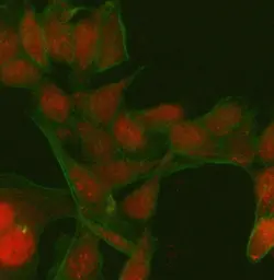 Anti-PATZ1 antibody used in Immunocytochemistry/ Immunofluorescence (ICC/IF). GTX04950