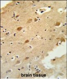 Anti-GAL3ST1 antibody used in IHC (Paraffin sections) (IHC-P). GTX04952