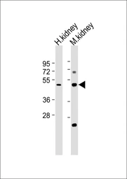 Anti-GAL3ST1 antibody used in Western Blot (WB). GTX04952
