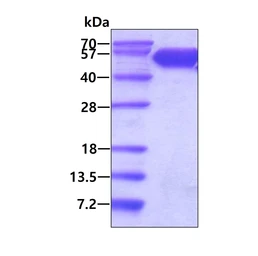 Human CD47 (ECD) protein, Human IgG Fc tag and His tag. GTX04956-pro