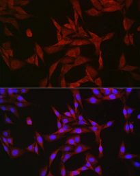 Anti-GATSL3 antibody used in Immunocytochemistry/ Immunofluorescence (ICC/IF). GTX04958