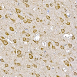 Anti-GATSL3 antibody used in IHC (Paraffin sections) (IHC-P). GTX04958