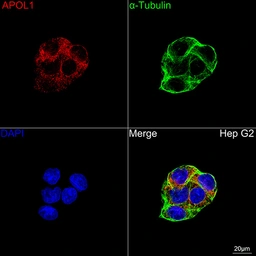 Anti-Apolipoprotein L1 antibody [ARC1124] used in Immunocytochemistry/ Immunofluorescence (ICC/IF). GTX04962