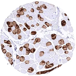 Anti-MYH7 antibody [MSVA-464M] HistoMAX&trade; used in IHC (Paraffin sections) (IHC-P). GTX04970