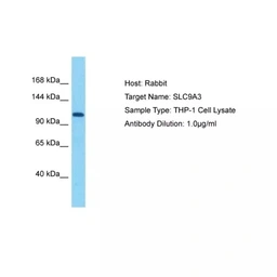 Anti-NHE3 antibody used in Western Blot (WB). GTX04975