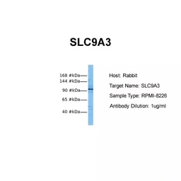 Anti-NHE3 antibody used in Western Blot (WB). GTX04975