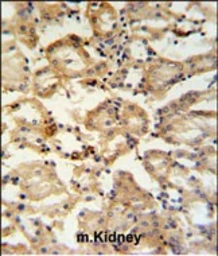Anti-RHBG antibody used in IHC (Paraffin sections) (IHC-P). GTX04978