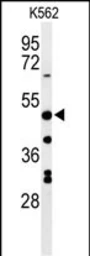 Anti-RHBG antibody used in Western Blot (WB). GTX04978