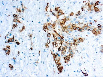 Anti-Mesothelin antibody [YP158] (ready-to-use) used in IHC (Paraffin sections) (IHC-P). GTX04979