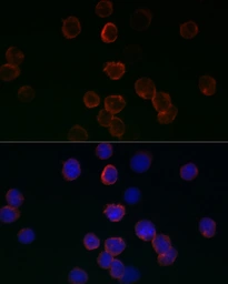 Anti-GPX1 antibody used in Immunocytochemistry/ Immunofluorescence (ICC/IF). GTX04981