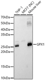 Anti-GPX1 antibody used in Western Blot (WB). GTX04981