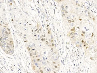 Anti-Anillin antibody used in IHC (Paraffin sections) (IHC-P). GTX04983
