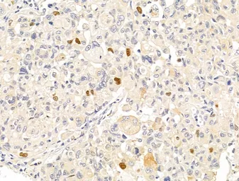 Anti-Anillin antibody used in IHC (Paraffin sections) (IHC-P). GTX04983
