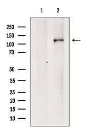 Anti-Anillin antibody used in Western Blot (WB). GTX04983