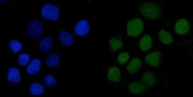 Anti-Anillin antibody used in Immunocytochemistry/ Immunofluorescence (ICC/IF). GTX04984