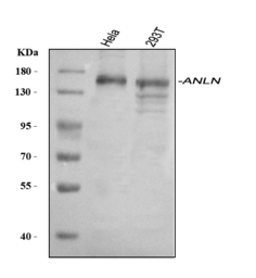 Anti-Anillin antibody used in Western Blot (WB). GTX04984
