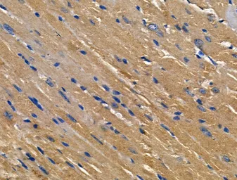 Anti-Interferon gamma antibody used in IHC (Paraffin sections) (IHC-P). GTX04987
