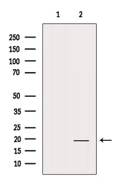 Anti-Interferon gamma antibody used in Western Blot (WB). GTX04987