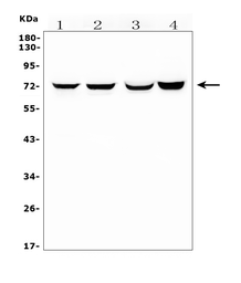 Anti-HIF3 alpha antibody used in Western Blot (WB). GTX04988