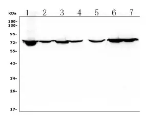 Anti-HIF3 alpha antibody used in Western Blot (WB). GTX04988