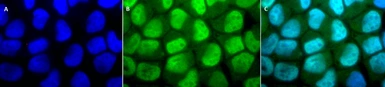 Anti-Methylated Lysine antibody used in Immunocytochemistry/ Immunofluorescence (ICC/IF). GTX04989