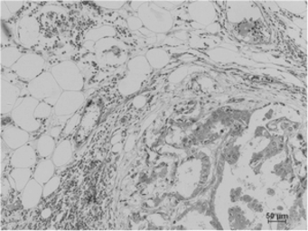 Anti-Methylated Lysine antibody [SR4513] used in IHC (Paraffin sections) (IHC-P). GTX04990