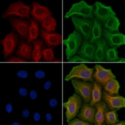 Anti-5-HT2C receptor antibody used in Immunocytochemistry/ Immunofluorescence (ICC/IF). GTX04991