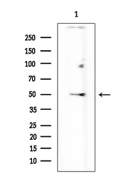 Anti-5-HT2C receptor antibody used in Western Blot (WB). GTX04991