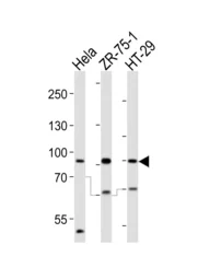 Anti-SCUBE2 antibody used in Western Blot (WB). GTX04992