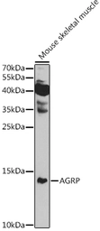 Anti-AGRP antibody used in Western Blot (WB). GTX04995