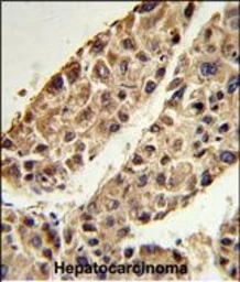 Anti-ITIH2 antibody used in IHC (Paraffin sections) (IHC-P). GTX04997