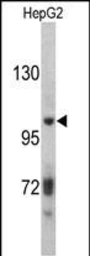 Anti-ITIH2 antibody used in Western Blot (WB). GTX04997