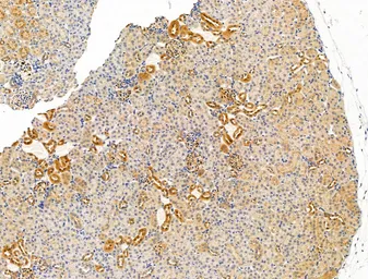 Anti-ITIH2 antibody used in IHC (Paraffin sections) (IHC-P). GTX04998