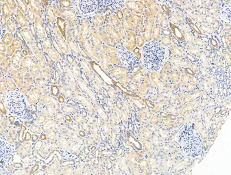 Anti-ITIH2 antibody used in IHC (Paraffin sections) (IHC-P). GTX04998