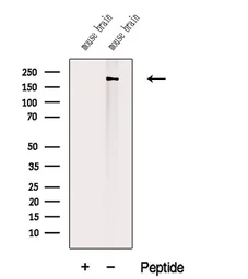 Anti-Titin antibody used in Western Blot (WB). GTX05000