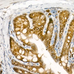 Anti-APC antibody [ARC53932] used in IHC (Paraffin sections) (IHC-P). GTX05003