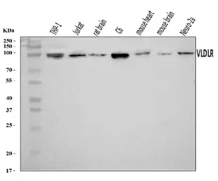 Anti-VLDL Receptor antibody used in Western Blot (WB). GTX05004