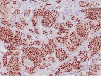 Anti-PIT1 antibody [PIT1/7262] used in IHC (Paraffin sections) (IHC-P). GTX05006