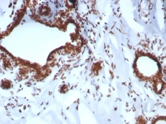 Anti-BAP1 antibody [BAP1/8959R] used in IHC (Paraffin sections) (IHC-P). GTX05007