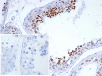 Anti-Snurportin 1 antibody [SNUPN/7351R] used in IHC (Paraffin sections) (IHC-P). GTX05011